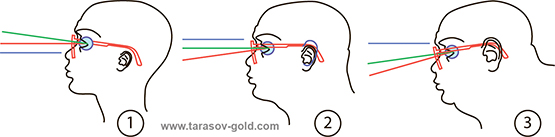 Рис. 3 Зависимость пантоскопического угла от наклона и анатомических особенностей строения головы человека. Правильные очки.